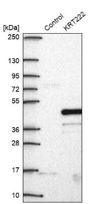 Western Blot: KRT222 Antibody [NBP2-46822]