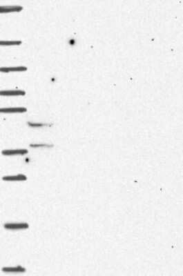 Western Blot: KRT222 Antibody [NBP3-17269]