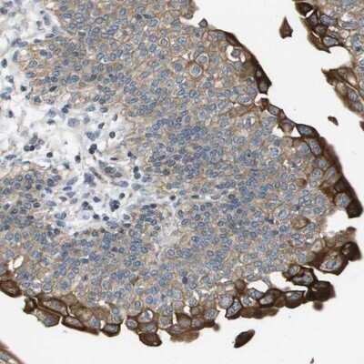 Immunohistochemistry-Paraffin: KRT23 Antibody [NBP1-85596]