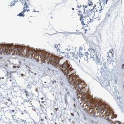 Immunohistochemistry-Paraffin: KRT23 Antibody [NBP1-85597]