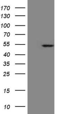 Western Blot: KRT23 Antibody (OTI3F2)Azide and BSA Free [NBP2-71780]