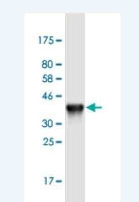 Western Blot: KRT24 Antibody (2D2) [H00192666-M01-100ug]