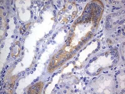 Immunohistochemistry: KRT24 Antibody (OTI4E8) [NBP2-45558]