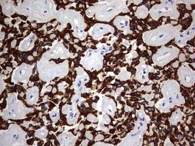 Immunohistochemistry: KRT24 Antibody (OTI4E8) [NBP2-45558]
