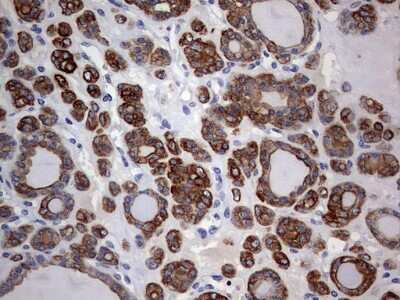 Immunohistochemistry: KRT24 Antibody (OTI4E8) [NBP2-45558]