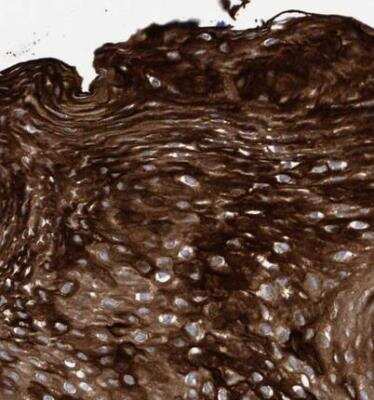 Immunohistochemistry-Paraffin: KRT24 Antibody [NBP1-83665]