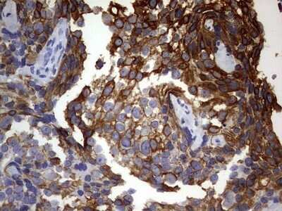 Immunohistochemistry: KRT24 Antibody (OTI4E8) - Azide and BSA Free [NBP2-72455]
