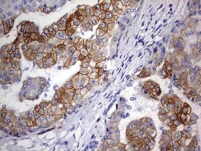 Immunohistochemistry: KRT24 Antibody (OTI4E8) - Azide and BSA Free [NBP2-72455]