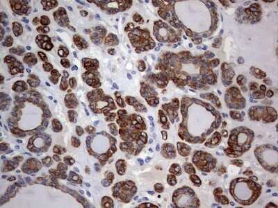 Immunohistochemistry: KRT24 Antibody (OTI4E8) - Azide and BSA Free [NBP2-72455]