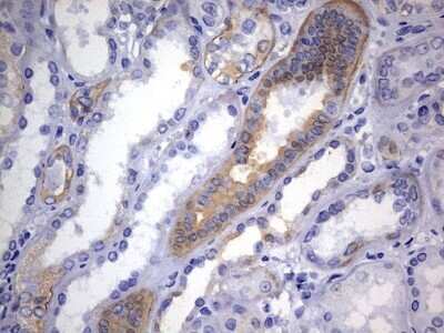 Immunohistochemistry: KRT24 Antibody (OTI4E8) - Azide and BSA Free [NBP2-72455]