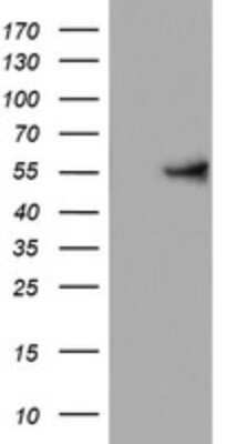 Western Blot: KRT24 Antibody (OTI4E8)Azide and BSA Free [NBP2-72455]