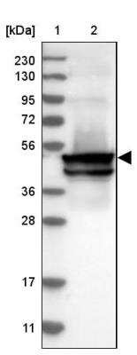 Western Blot: KRT24 Antibody [NBP1-83665]