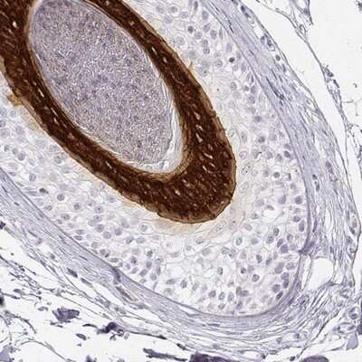 Immunohistochemistry-Paraffin: KRT25 Antibody [NBP2-30606]