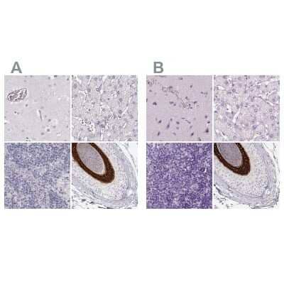 Immunohistochemistry-Paraffin: KRT25 Antibody [NBP2-30606]