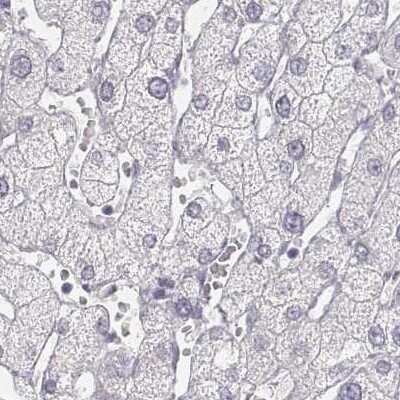 Immunohistochemistry-Paraffin: KRT25 Antibody [NBP2-30606]