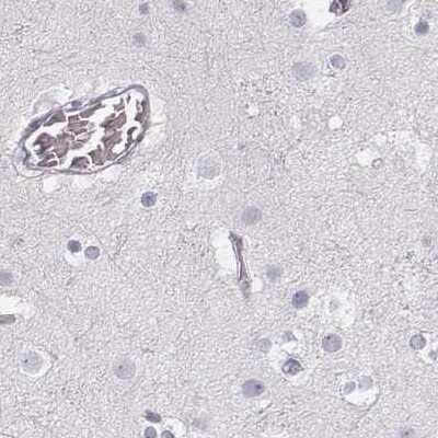 Immunohistochemistry-Paraffin: KRT25 Antibody [NBP2-30606]