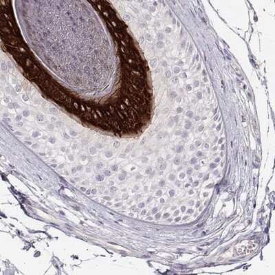 Immunohistochemistry-Paraffin: KRT25 Antibody [NBP2-58547]