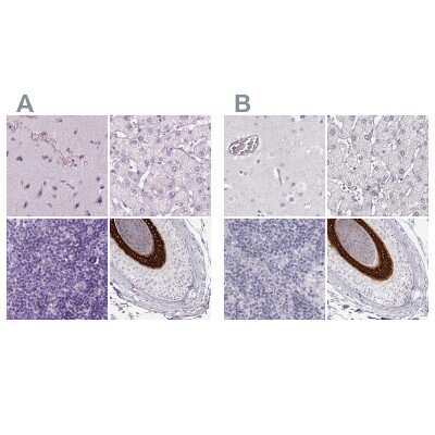 Immunohistochemistry-Paraffin: KRT25 Antibody [NBP2-58547]