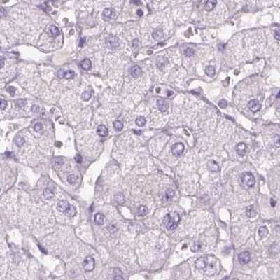Immunohistochemistry-Paraffin: KRT25 Antibody [NBP2-58547]