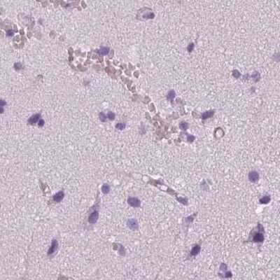 Immunohistochemistry-Paraffin: KRT25 Antibody [NBP2-58547]