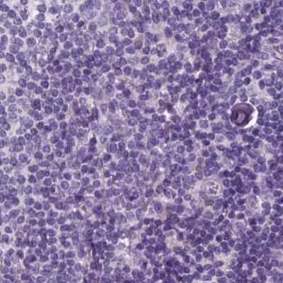 Immunohistochemistry-Paraffin: KRT25 Antibody [NBP2-58547]