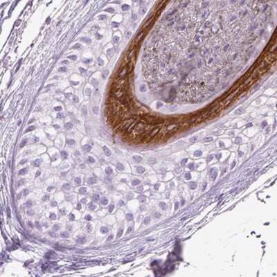 Immunohistochemistry-Paraffin: KRT28 Antibody [NBP2-57281]