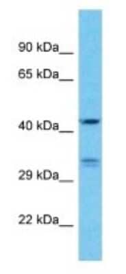 Western Blot: KRT33A Antibody [NBP3-09573]