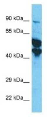 Western Blot: KRT33A Antibody [NBP3-09742]