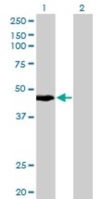 Western Blot: KRT34 Antibody (3E5) [H00003885-M10]