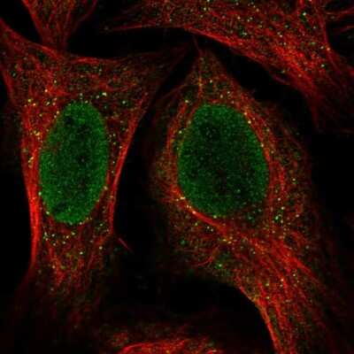 Immunocytochemistry/ Immunofluorescence: KRT34 Antibody [NBP2-58830]