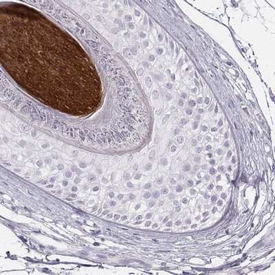 Immunohistochemistry-Paraffin: KRT34 Antibody [NBP2-58830]