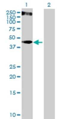 Western Blot: KRT34 Antibody [H00003885-B01P]