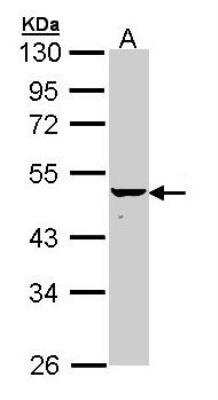 Western Blot: KRT34 Antibody [NBP1-33423]