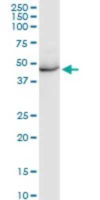 Western Blot: KRT35 Antibody [H00003886-D01P]