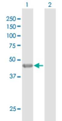 Western Blot: KRT35 Antibody [H00003886-D01P]