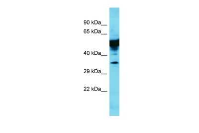 Western Blot: KRT35 Antibody [NBP2-84122]