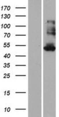 Western Blot: KRT35 Overexpression Lysate [NBP2-08131]