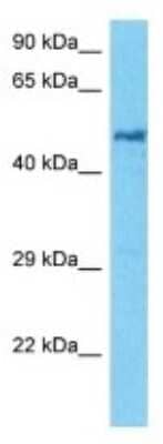 Western Blot: KRT42 Antibody [NBP3-10208]