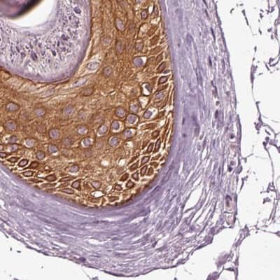 Immunohistochemistry-Paraffin: KRT6L Antibody [NBP2-31764]