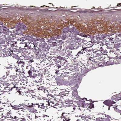 Immunohistochemistry-Paraffin: KRT6L Antibody [NBP2-31764]