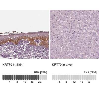 Immunohistochemistry-Paraffin: KRT6L Antibody [NBP2-31764]