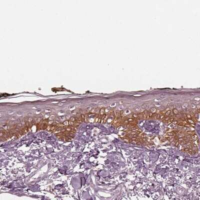 Immunohistochemistry-Paraffin: KRT6L Antibody [NBP2-31764]