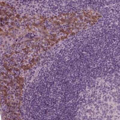 Immunohistochemistry-Paraffin: KRT6L Antibody [NBP2-31764]