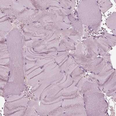 Immunohistochemistry-Paraffin: KRT6L Antibody [NBP2-31764]