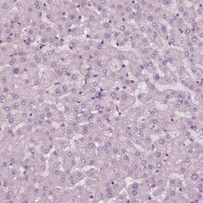 Immunohistochemistry-Paraffin: KRT6L Antibody [NBP2-31764]