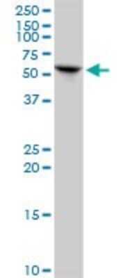 Western Blot: KRT6L Antibody [H00338785-B01P]