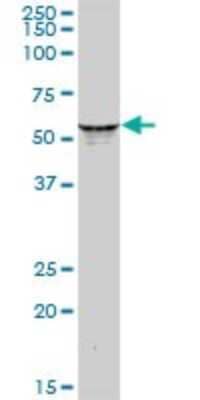 Western Blot: KRT6L Antibody [H00338785-B01P]