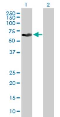 Western Blot: KRT6L Antibody [H00338785-B01P]