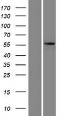 Western Blot: KRT73 Overexpression Lysate [NBP2-05076]