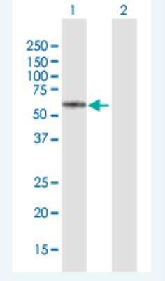 Western Blot: KRT74 Antibody [H00121391-B01P-50ug]
